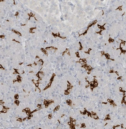 DCDC2 Antibody