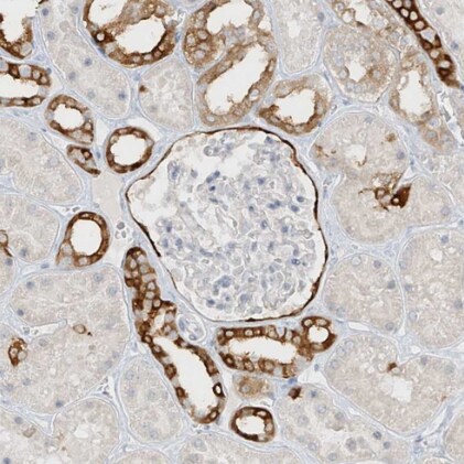 DCDC2 Antibody