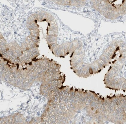 DCDC2 Antibody