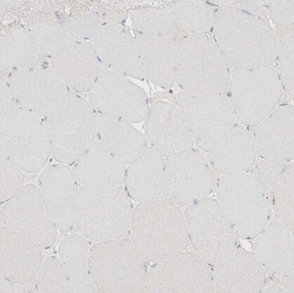 DCDC2 Antibody