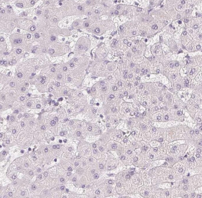 PLC-beta 1 Antibody - BSA Free