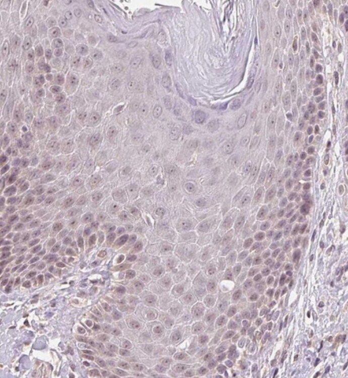 PLC-beta 1 Antibody - BSA Free