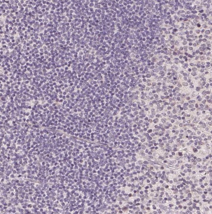 PLC-beta 1 Antibody - BSA Free