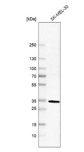 Annexin V Antibody