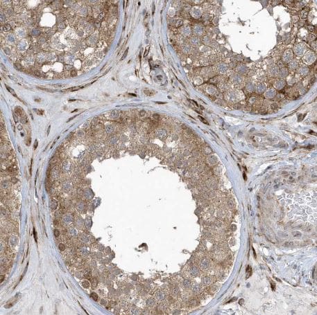 FAM98A Antibody FAM98A Antibody
