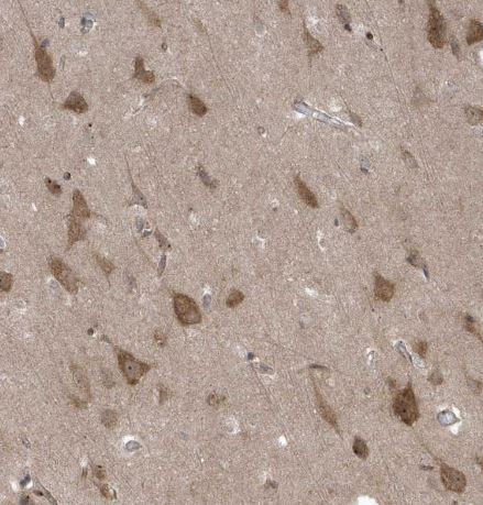FAM98A Antibody FAM98A Antibody