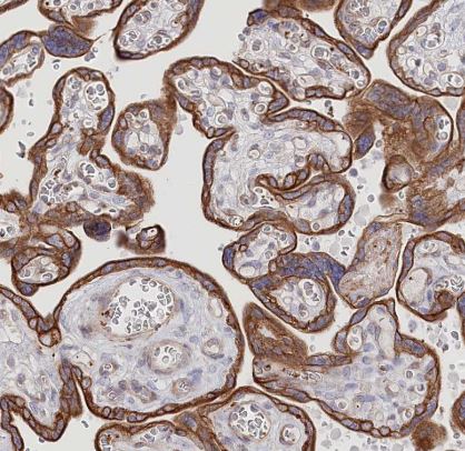 SLC39A10 Antibody