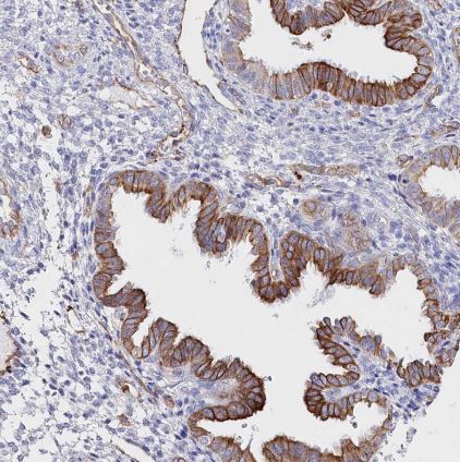 SLC39A10 Antibody