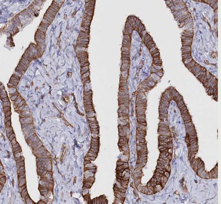 SLC39A10 Antibody