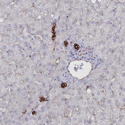 SLC39A10 Antibody
