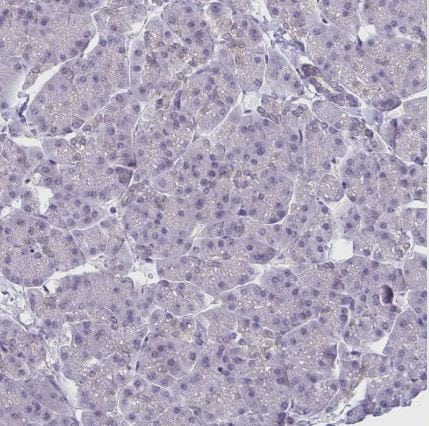 CSE1L/CAS/Exportin-2 Antibody