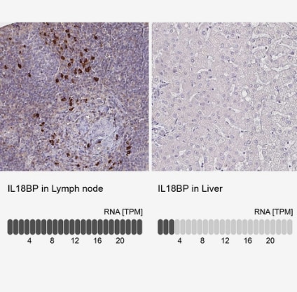 IL-18 BPa/IL18BP Antibody - BSA Free