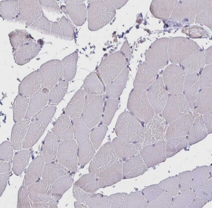 IL-18 BPa/IL18BP Antibody - BSA Free