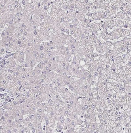 IL-18 BPa/IL18BP Antibody - BSA Free