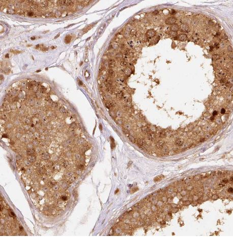 EIF3B Antibody