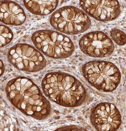EIF3B Antibody