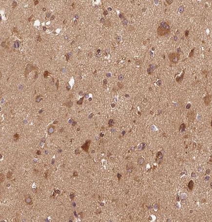 EIF3B Antibody