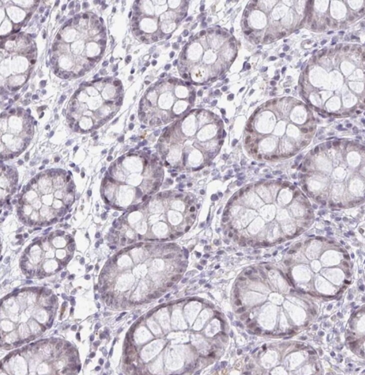 DNA Polymerase beta Antibody - BSA Free