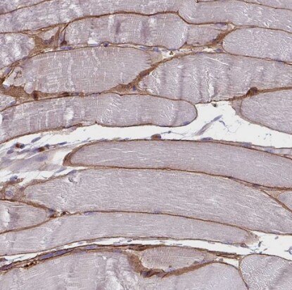 Adiponectin/Acrp30 Antibody - BSA Free