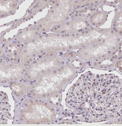 CCDC101 Antibody