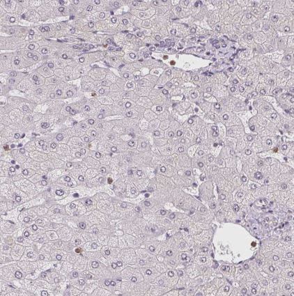 CCDC101 Antibody