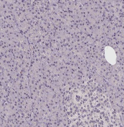 CCDC101 Antibody