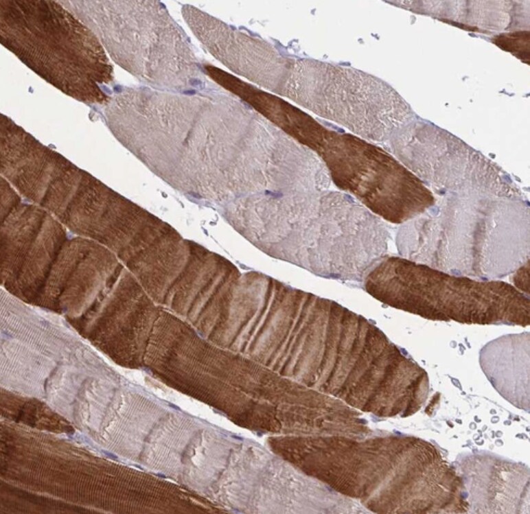 OSBPL7 Antibody - BSA Free