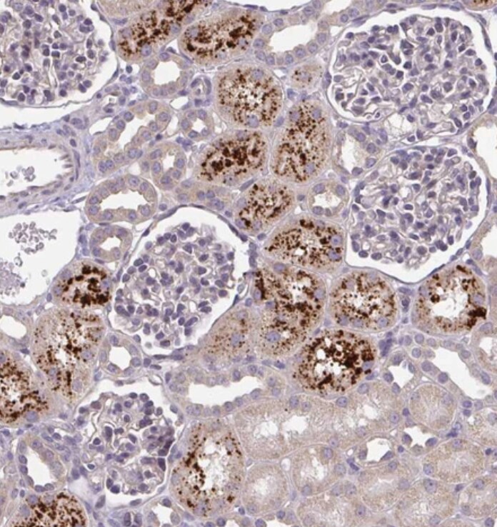 OSBPL7 Antibody - BSA Free