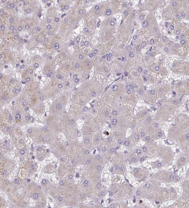 OSBPL7 Antibody - BSA Free