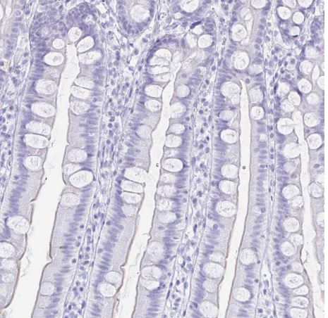 TIMP-1 Antibody