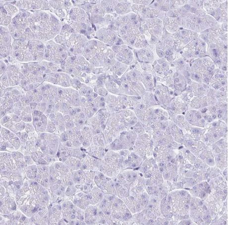TIMP-1 Antibody