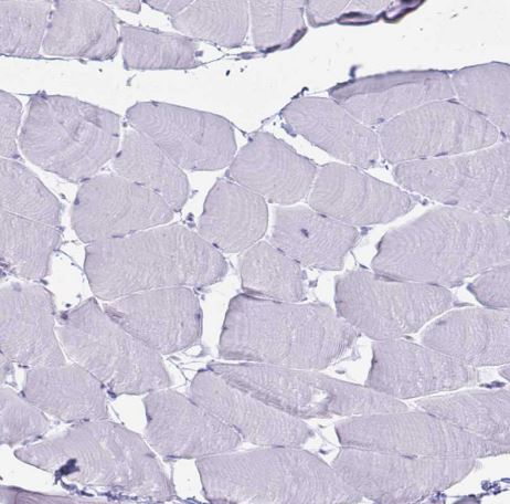 TIMP-1 Antibody