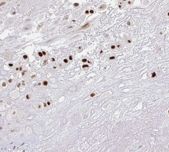 RCOR1/CoREST Antibody - BSA Free