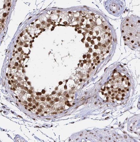 SNRPC Antibody