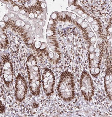 SNRPC Antibody