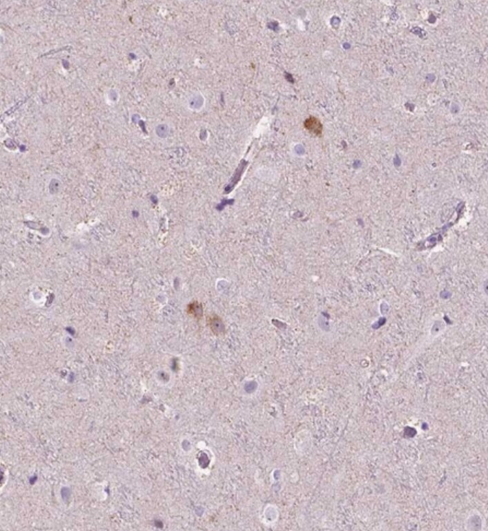 NOS1AP Antibody - BSA Free