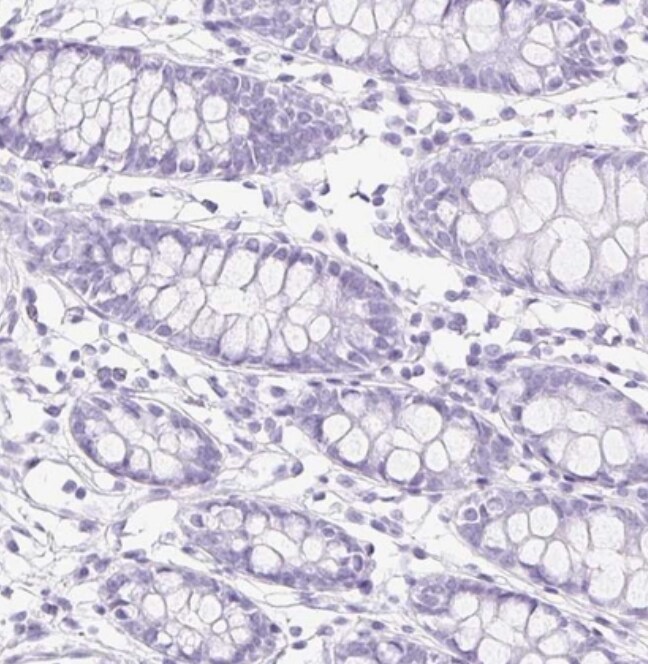 Claudin-16 Antibody - BSA Free