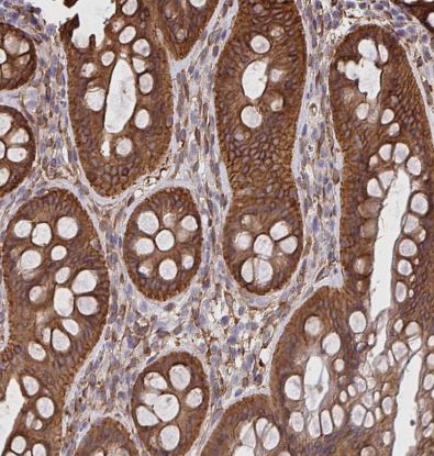 Cortactin Antibody