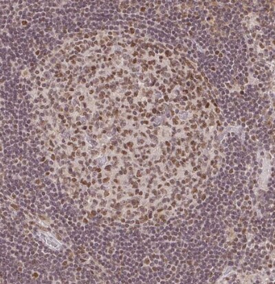 DEK Antibody