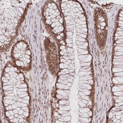 DEK Antibody