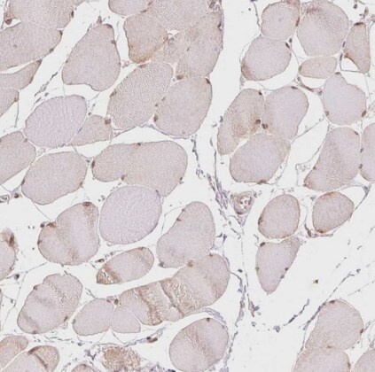 DEK Antibody