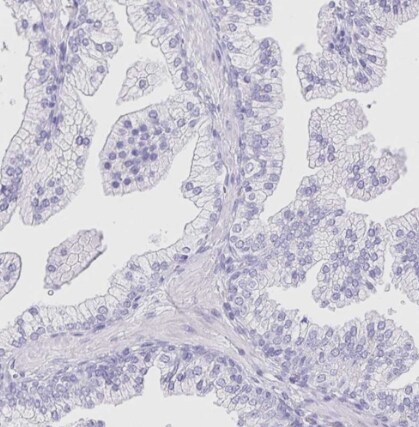 Pancreatic Lipase Antibody - BSA Free