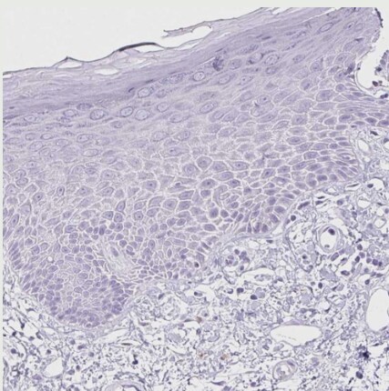 Pancreatic Lipase Antibody - BSA Free