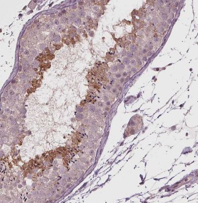 CXCL16 Antibody