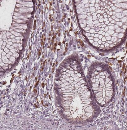 CXCL16 Antibody