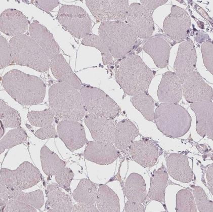 CXCL16 Antibody
