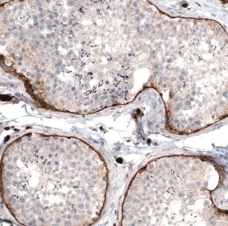 Laminin Antibody (CL2968)