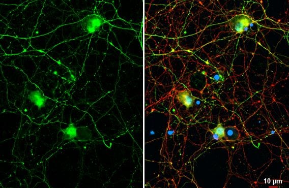GABA Antibody