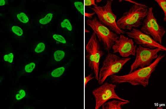 RNASEH2B Antibody (479)