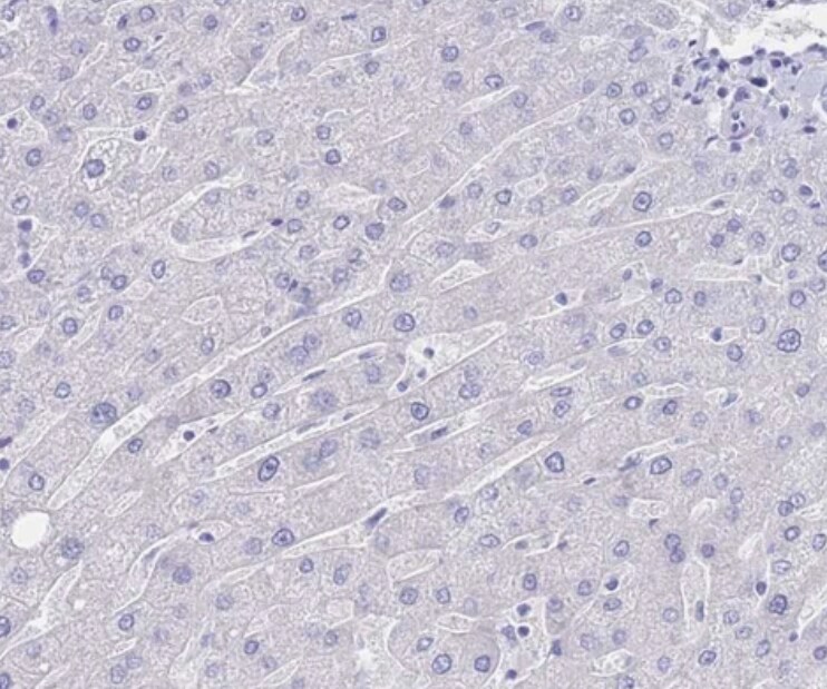 LRRC37A Antibody - BSA Free